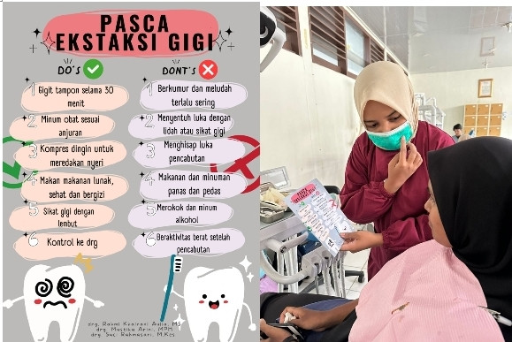 Perawatan Pasien Ekstraksi Gigi Dewasa di Rumah Sakit Gigi dan Mulut Universitas Andalas 